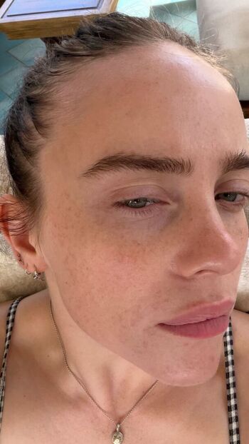 🔥 Billie eilish  page leaked private photo uncensored full