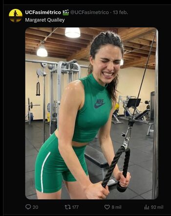 🔥 Billie eilish  page leaked private photo uncensored full