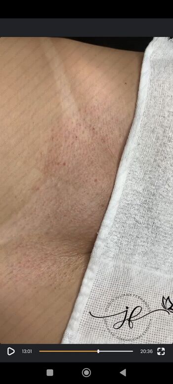 🔥 Bronzeamento natural page leaked private photo uncensored full