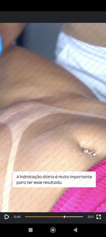 🔥 Bronzeamento natural page leaked private photo uncensored full