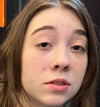 🔥 Humorchampion leaked private photo uncensored full