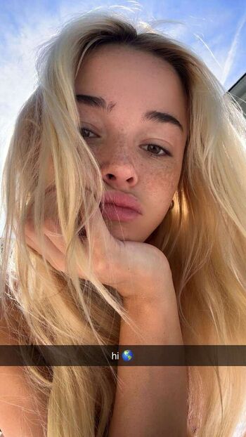 Livvy Dunne