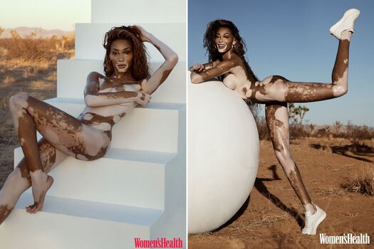 Full leaked Winnieharlow private onlyfans photo