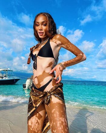 Full leaked Winnieharlow private onlyfans photo
