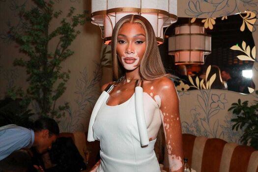 Full leaked Winnieharlow private onlyfans photo