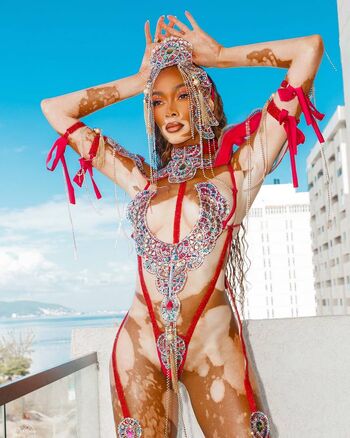 winnieharlow