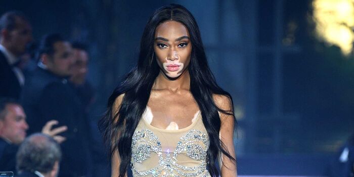 Full leaked Winnieharlow private onlyfans photo