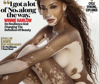 Full leaked Winnieharlow private onlyfans photo